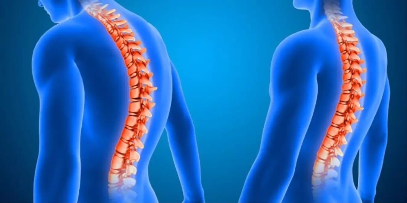 Ortopedi Tedavilerinde Yapay Zeka ve Robot Teknolojileri Dönemi